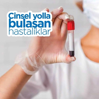 cinsel yolla bulaşan hastalıklar nelerdir